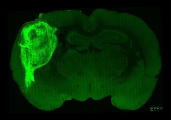 Implantan 'minicerebros' derivados de células humanas a ratas
