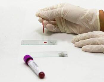 Crean una prueba rápida para medir la inmunidad a la COVID